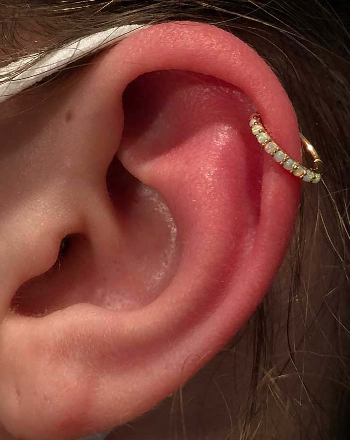 Cartilage
