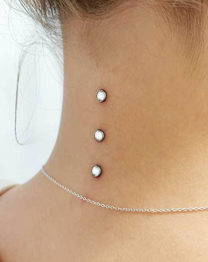 Dermal
