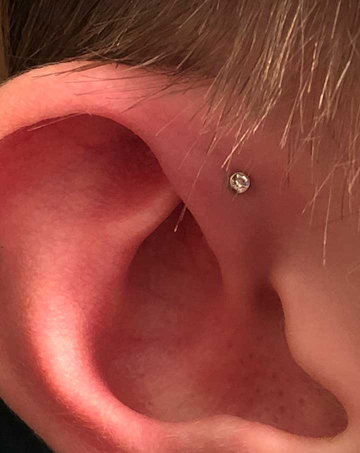 Forward Helix