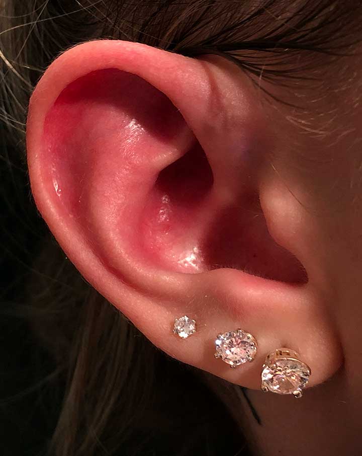 Lobes