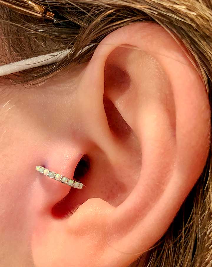 Tragus